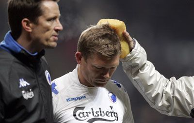 Marcus Allbäck